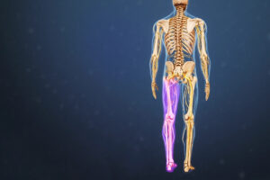 ماساژ درمان عصب سیاتیک پای چپ